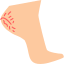 cracked-skin