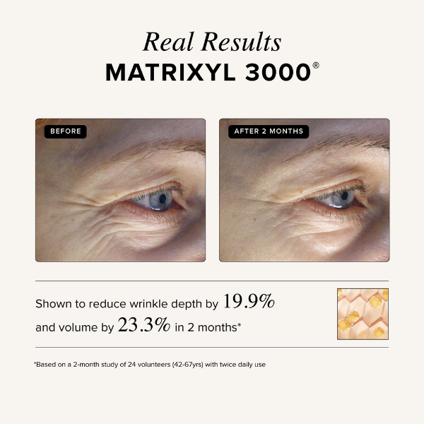 Triple Repair Moisturizing Cream - Image 4