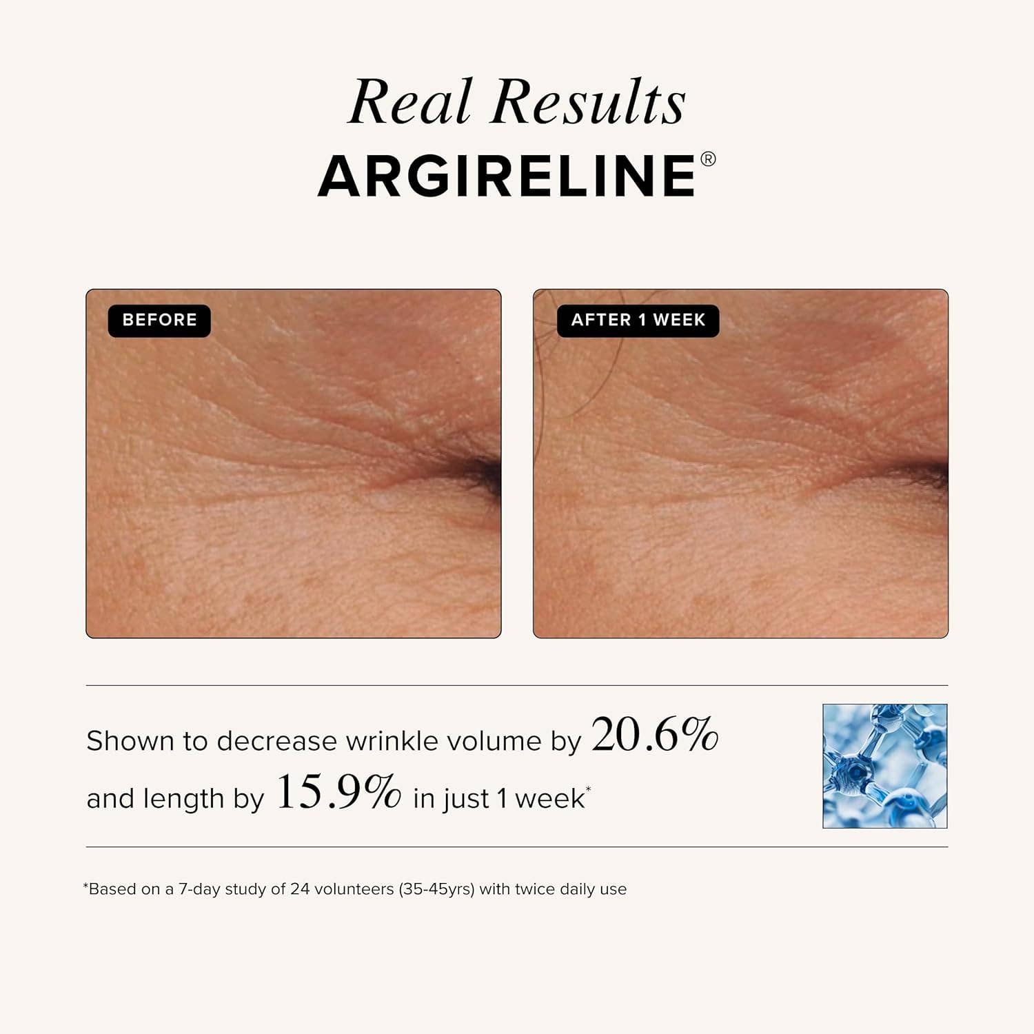 Matrixyl 3000 + Argireline Serum: 1oz - Image 5
