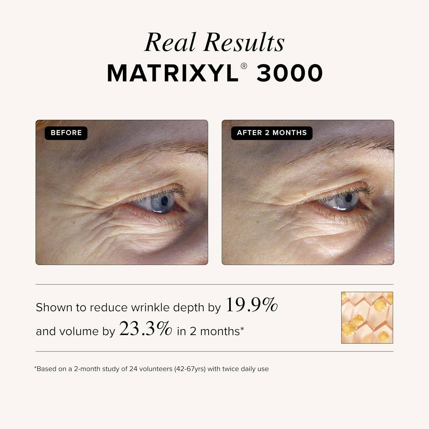 Matrixyl 3000 + Argireline Serum: 1oz - Image 4